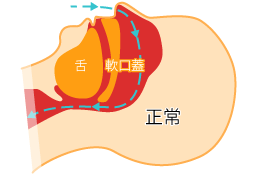 睡眠時無呼吸症候群について